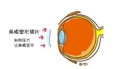 进出口眼镜报关如何归类？